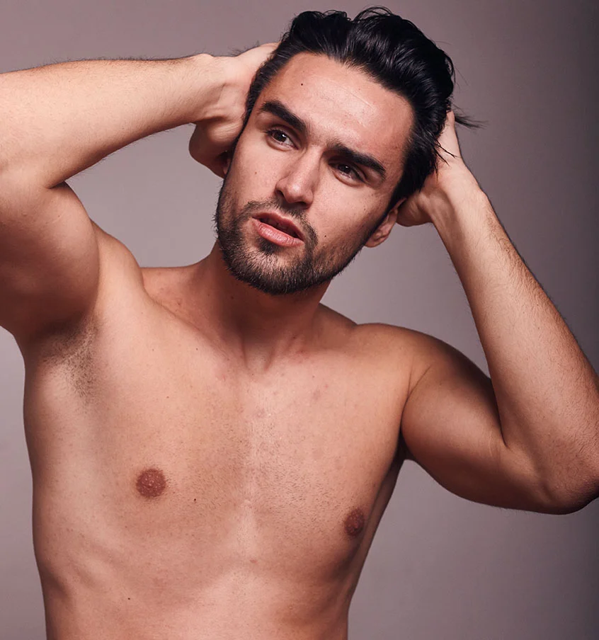 gynecomastia-what